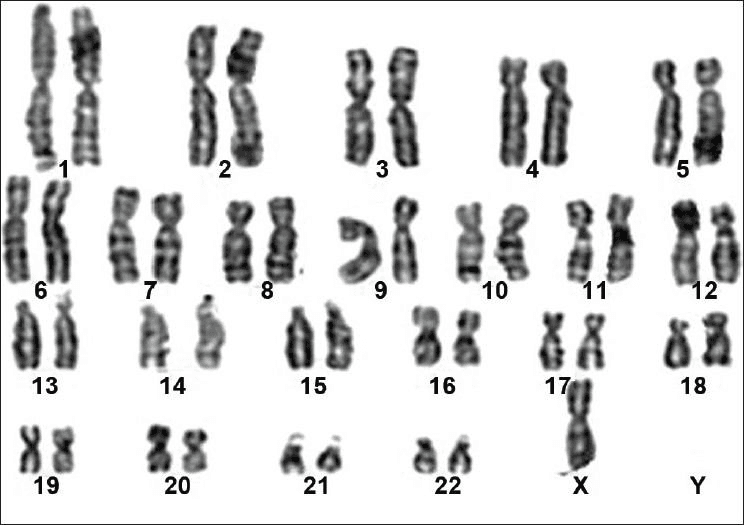 Karyotypes Check-in Quiz | Essential Grade 9-11 Science