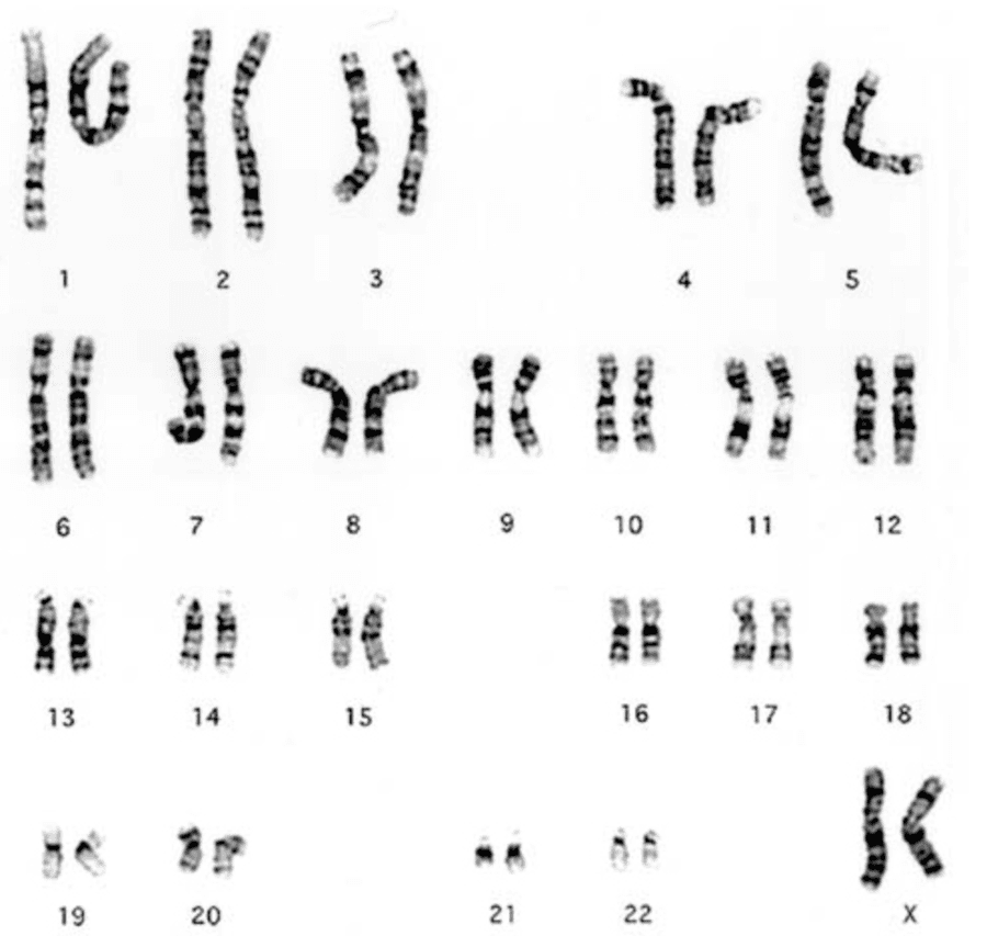Karyotypes Quiz: Essential Grade 10 Science Worksheet