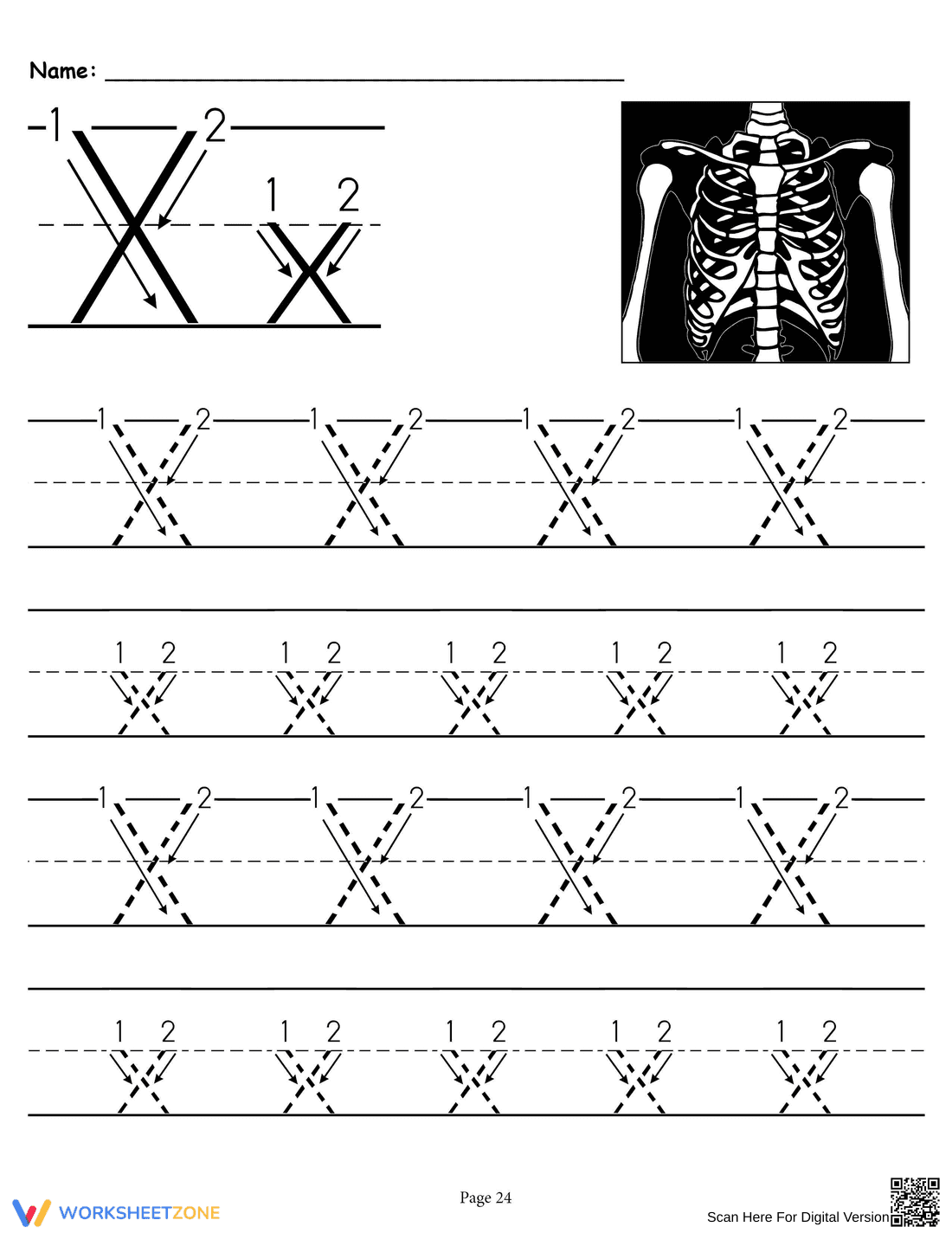 Tracing Letter X Practice - Page 1